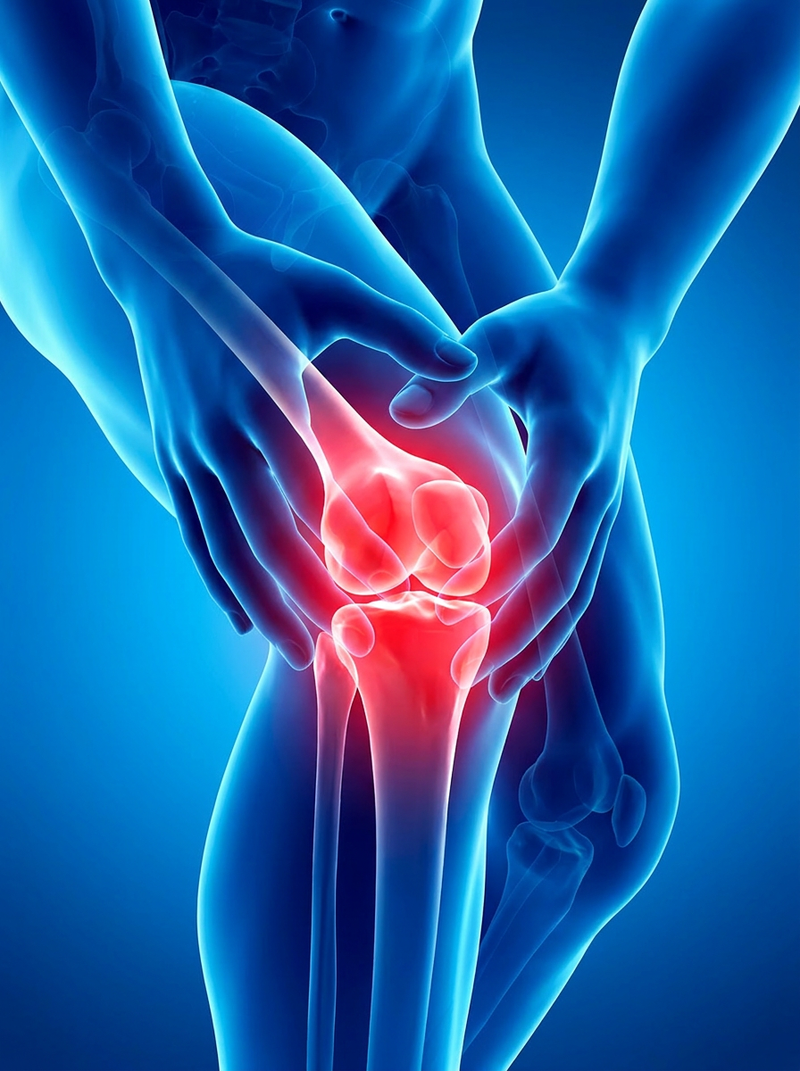 Knee Osteoarthritis
