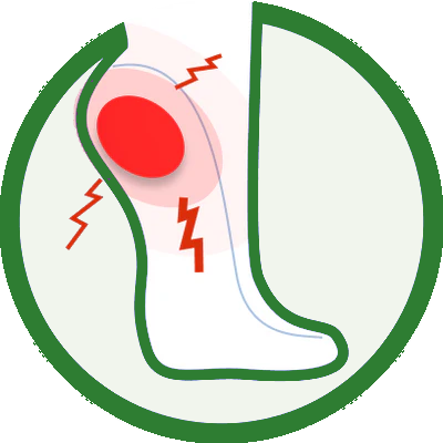 Plantar Fasciitis